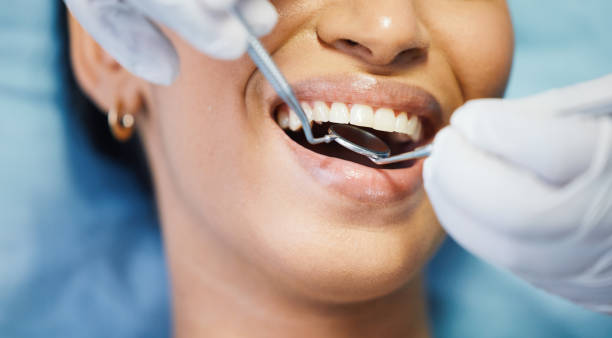 Best Dental Abscess Treatment in Oak Grove, AL